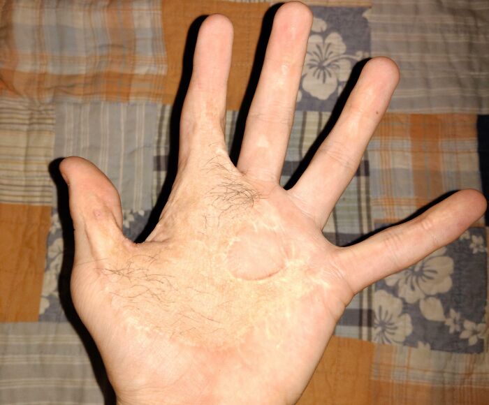 65 Photos Of The Human Body In Shapes And Conditions You Might Not Have Seen Before