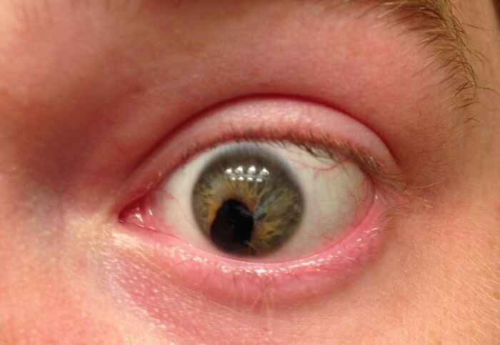 65 Photos Of The Human Body In Shapes And Conditions You Might Not Have Seen Before