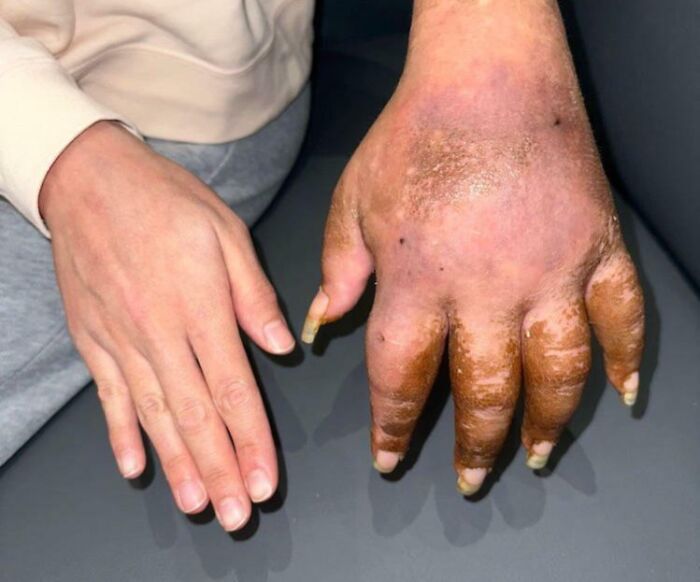 65 Photos Of The Human Body In Shapes And Conditions You Might Not Have Seen Before