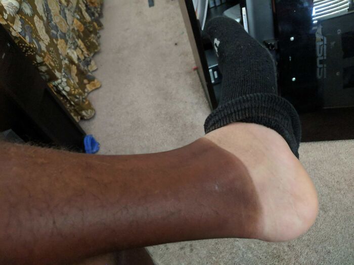 65 Photos Of The Human Body In Shapes And Conditions You Might Not Have Seen Before