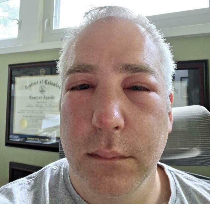 65 Photos Of The Human Body In Shapes And Conditions You Might Not Have Seen Before