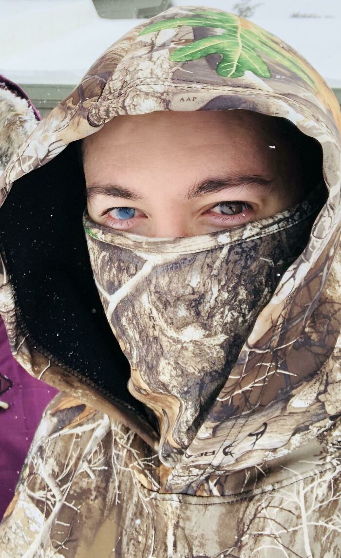 65 Photos Of The Human Body In Shapes And Conditions You Might Not Have Seen Before