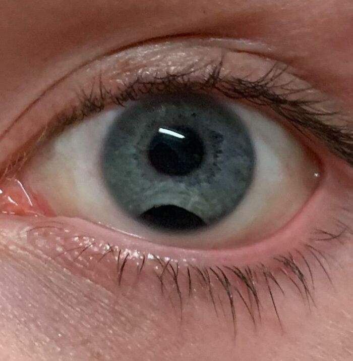 65 Photos Of The Human Body In Shapes And Conditions You Might Not Have Seen Before