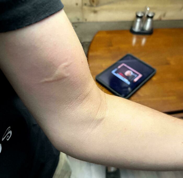 65 Photos Of The Human Body In Shapes And Conditions You Might Not Have Seen Before