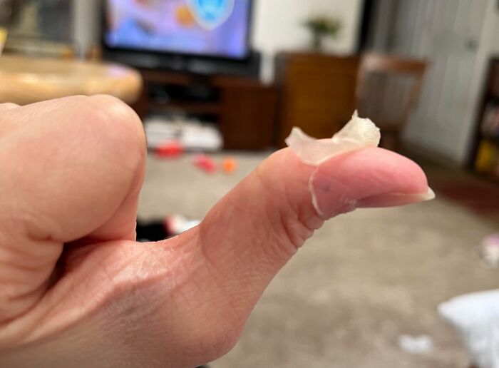 65 Photos Of The Human Body In Shapes And Conditions You Might Not Have Seen Before