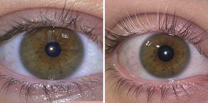 65 Photos Of The Human Body In Shapes And Conditions You Might Not Have Seen Before