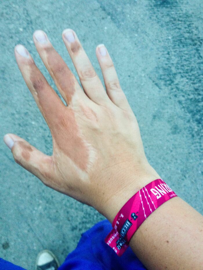 65 Photos Of The Human Body In Shapes And Conditions You Might Not Have Seen Before