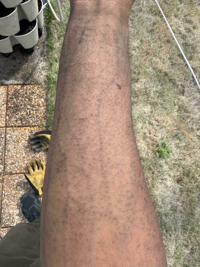 65 Photos Of The Human Body In Shapes And Conditions You Might Not Have Seen Before