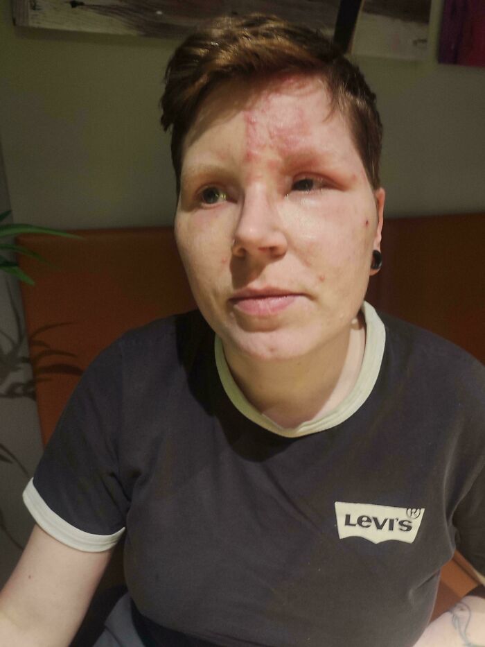 65 Photos Of The Human Body In Shapes And Conditions You Might Not Have Seen Before