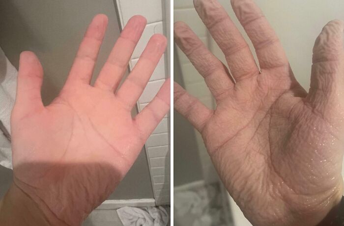 65 Photos Of The Human Body In Shapes And Conditions You Might Not Have Seen Before