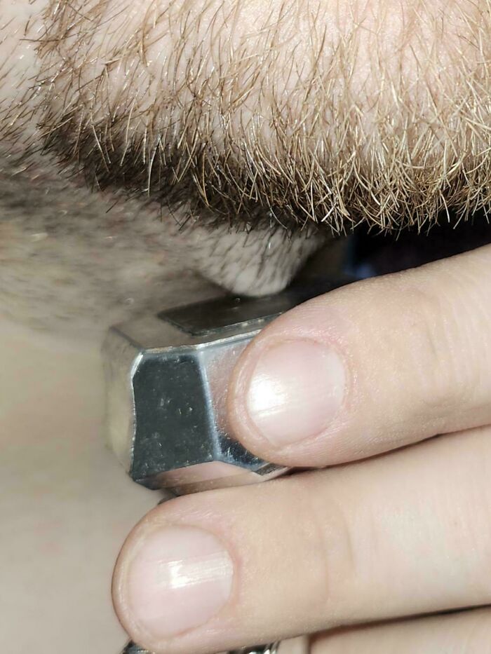 65 Photos Of The Human Body In Shapes And Conditions You Might Not Have Seen Before