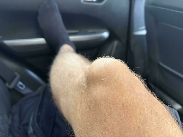 65 Photos Of The Human Body In Shapes And Conditions You Might Not Have Seen Before