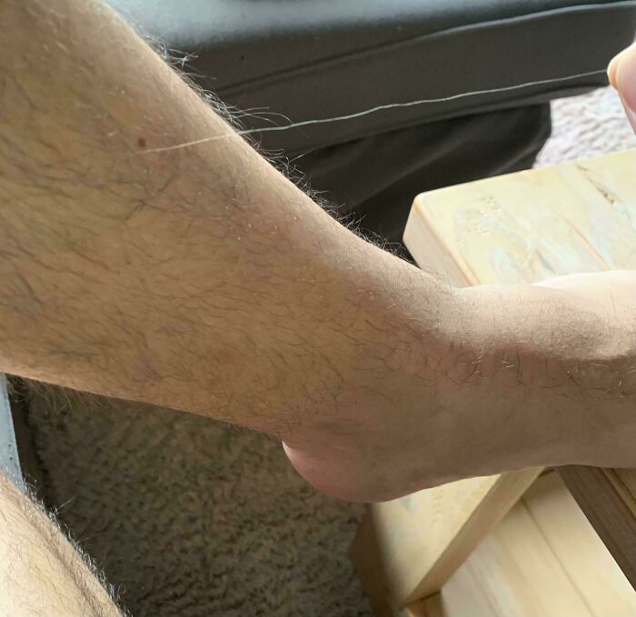 65 Photos Of The Human Body In Shapes And Conditions You Might Not Have Seen Before