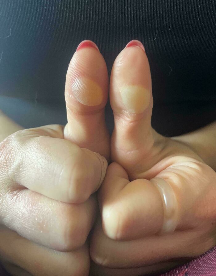 65 Photos Of The Human Body In Shapes And Conditions You Might Not Have Seen Before