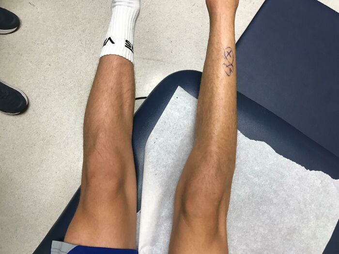 65 Photos Of The Human Body In Shapes And Conditions You Might Not Have Seen Before