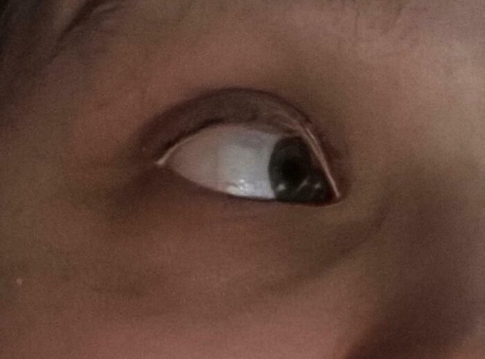 65 Photos Of The Human Body In Shapes And Conditions You Might Not Have Seen Before