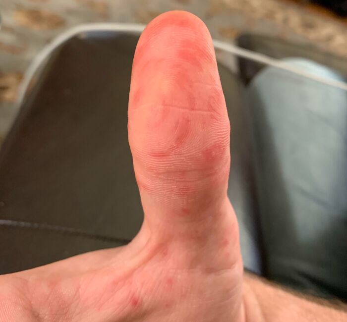 65 Photos Of The Human Body In Shapes And Conditions You Might Not Have Seen Before