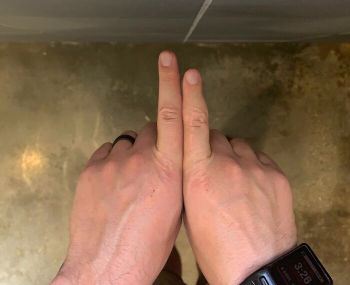 65 Photos Of The Human Body In Shapes And Conditions You Might Not Have Seen Before