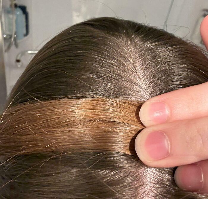 65 Photos Of The Human Body In Shapes And Conditions You Might Not Have Seen Before