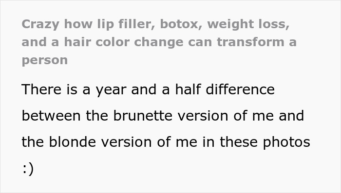 Woman Shows Her Crazy Transformation, People Can’t Believe It: “Lip Fillers, Botox, Weight Loss”