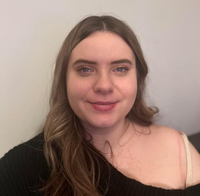 Woman Shows Her Crazy Transformation, People Can’t Believe It: “Lip Fillers, Botox, Weight Loss”