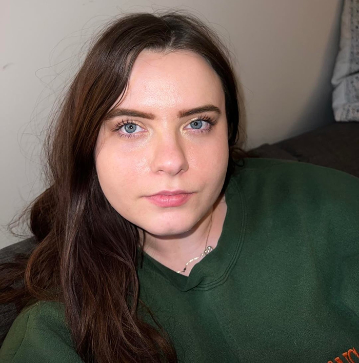 Woman Shows Her Crazy Transformation, People Can’t Believe It: “Lip Fillers, Botox, Weight Loss”