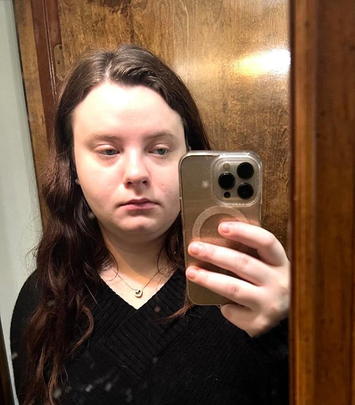 Woman Shows Her Crazy Transformation, People Can’t Believe It: “Lip Fillers, Botox, Weight Loss”