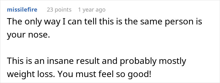 Woman Shows Her Crazy Transformation, People Can’t Believe It: “Lip Fillers, Botox, Weight Loss”