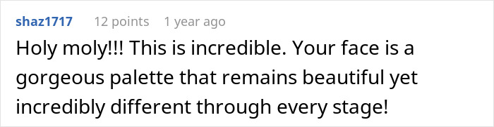 Woman Shows Her Crazy Transformation, People Can’t Believe It: “Lip Fillers, Botox, Weight Loss”