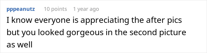 Woman Shows Her Crazy Transformation, People Can’t Believe It: “Lip Fillers, Botox, Weight Loss”