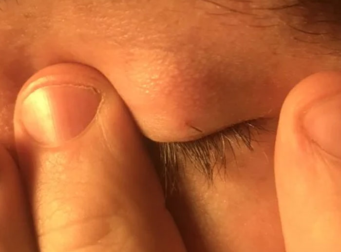 These 77 Weird Body Quirks Prove That The Human Body Is Fascinating