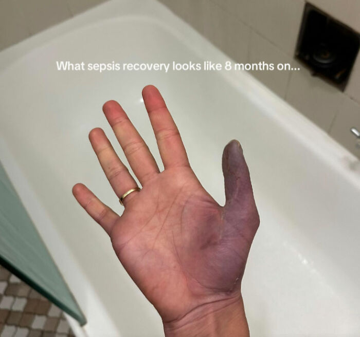 Young Woman Issues Urgent Warning About Going To Nail Salons After She Ended Up In The Hospital