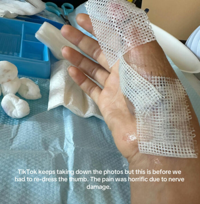 Young Woman Issues Urgent Warning About Going To Nail Salons After She Ended Up In The Hospital