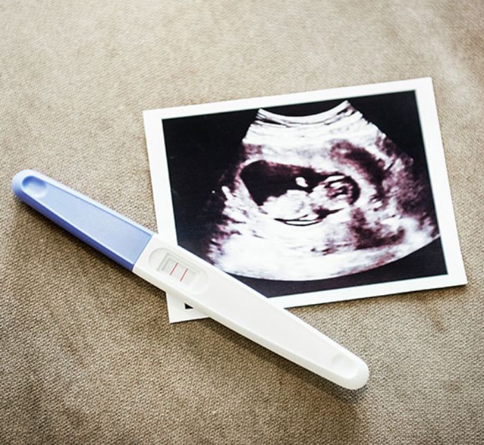 Woman Shares Bizarre Pregnancy Symptom, And It Freaks Out Netizens