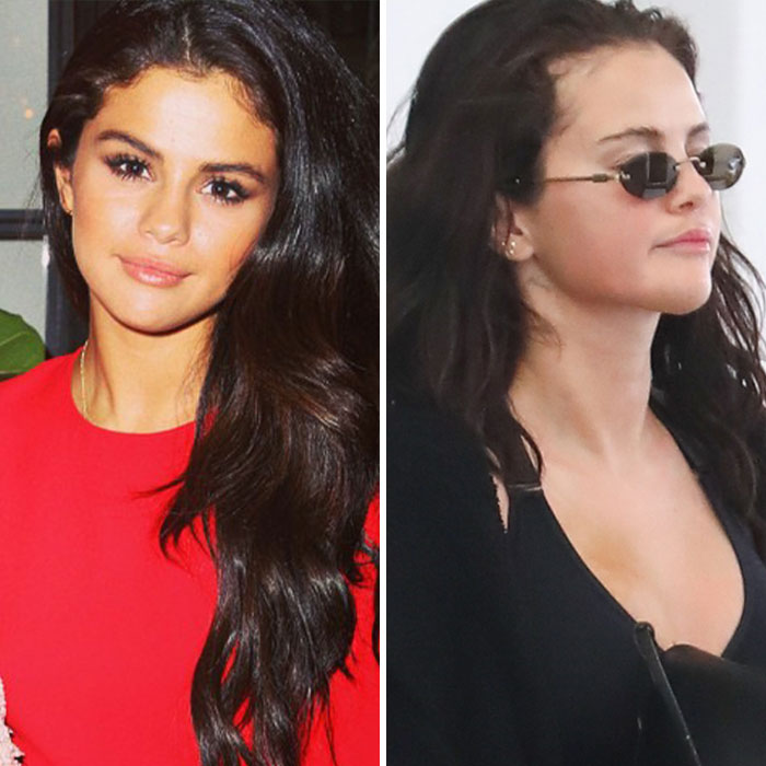 Selena Gomez Caught Leaving Clinic After Denying Plastic Surgery, Triggers Heated Reactions