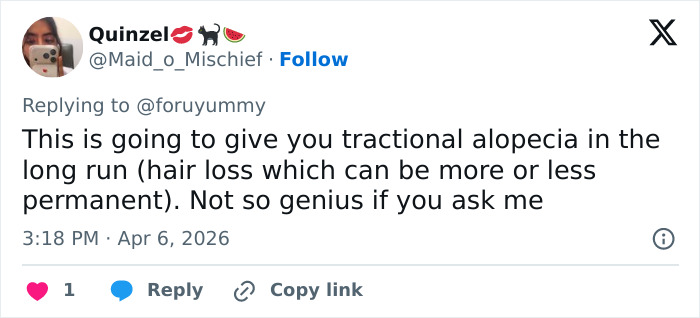 “This Is Actually Genius”: How To Fake A Facelift Like Anne Hathaway Did At The Oscars