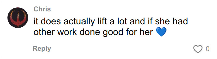 “This Is Actually Genius”: How To Fake A Facelift Like Anne Hathaway Did At The Oscars