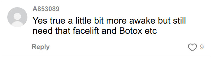 “This Is Actually Genius”: How To Fake A Facelift Like Anne Hathaway Did At The Oscars