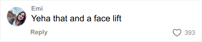 “This Is Actually Genius”: How To Fake A Facelift Like Anne Hathaway Did At The Oscars