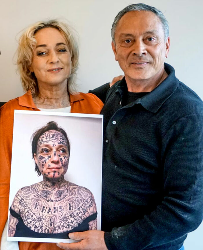 After Partner Forced 250 Tattoos Of His Name Onto Her, 52YO Woman’s Tattoo Removal Transformation Stuns