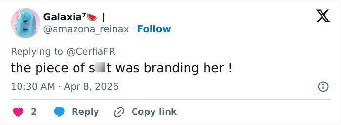 After Partner Forced 250 Tattoos Of His Name Onto Her, 52YO Woman’s Tattoo Removal Transformation Stuns