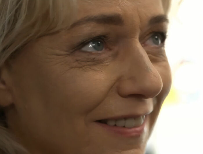 After Partner Forced 250 Tattoos Of His Name Onto Her, 52YO Woman’s Tattoo Removal Transformation Stuns