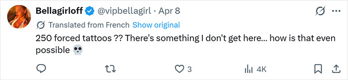 After Partner Forced 250 Tattoos Of His Name Onto Her, 52YO Woman’s Tattoo Removal Transformation Stuns