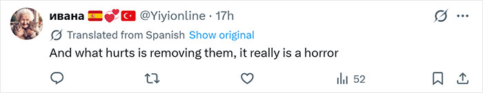 After Partner Forced 250 Tattoos Of His Name Onto Her, 52YO Woman’s Tattoo Removal Transformation Stuns