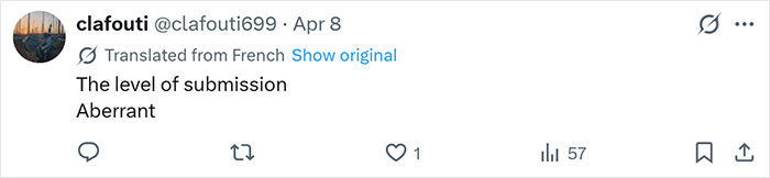 After Partner Forced 250 Tattoos Of His Name Onto Her, 52YO Woman’s Tattoo Removal Transformation Stuns