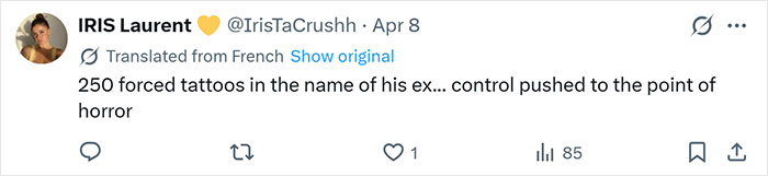 After Partner Forced 250 Tattoos Of His Name Onto Her, 52YO Woman’s Tattoo Removal Transformation Stuns