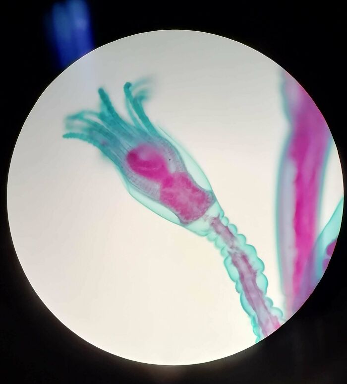 72 Unbelievable Microscope Images That Look Like They’re From Another Planet 72 Unbelievable Microscope Images That Look Like They’re From Another Planet