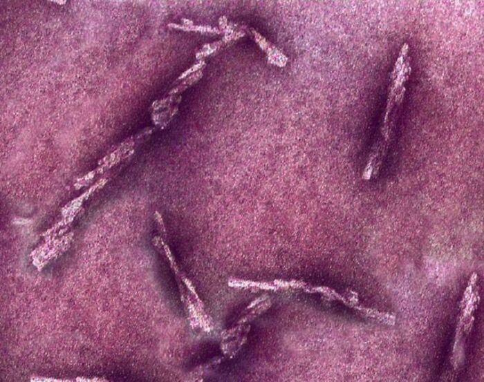 72 Unbelievable Microscope Images That Look Like They’re From Another Planet 72 Unbelievable Microscope Images That Look Like They’re From Another Planet