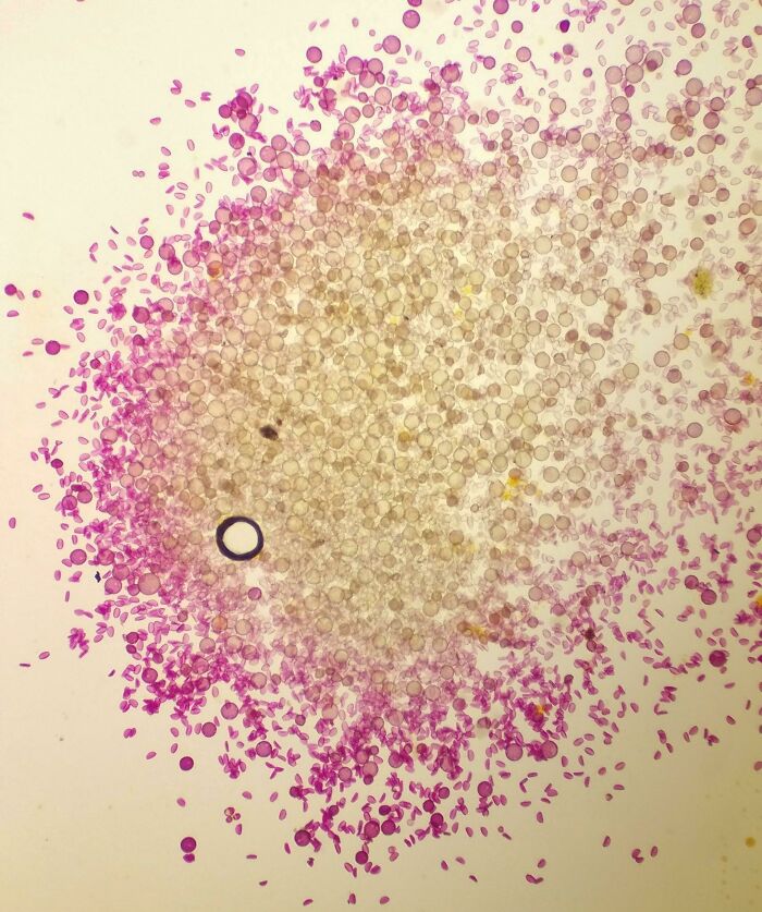 72 Unbelievable Microscope Images That Look Like They’re From Another Planet 72 Unbelievable Microscope Images That Look Like They’re From Another Planet