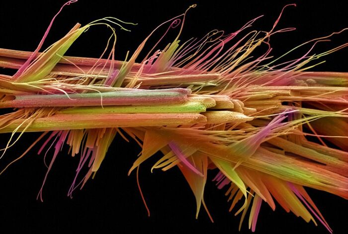 72 Unbelievable Microscope Images That Look Like They’re From Another Planet 72 Unbelievable Microscope Images That Look Like They’re From Another Planet